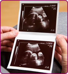 Woman holding scan photos